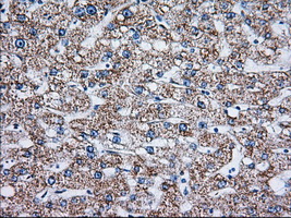 TTC32 Antibody - IHC of paraffin-embedded Human liver tissue using anti-TTC32 mouse monoclonal antibody. (Dilution 1:50).