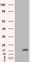TTC32 Antibody - HEK293T cells were transfected with the pCMV6-ENTRY control (Left lane) or pCMV6-ENTRY TTC32 (Right lane) cDNA for 48 hrs and lysed. Equivalent amounts of cell lysates (5 ug per lane) were separated by SDS-PAGE and immunoblotted with anti-TTC32.