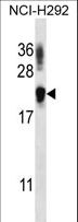 TTC33 Antibody - TTC33 Antibody western blot of NCI-H292 cell line lysates (35 ug/lane). The TTC33 antibody detected the TTC33 protein (arrow).