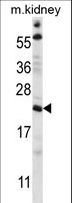 TTC33 Antibody - TTC33 Antibody western blot of mouse kidney tissue lysates (35 ug/lane). The TTC33 antibody detected the TTC33 protein (arrow).