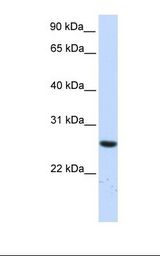 TTC33 Antibody - Fetal liver lysate. Antibody concentration: 1.0 ug/ml. Gel concentration: 12%.  This image was taken for the unconjugated form of this product. Other forms have not been tested.