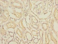 TTC33 Antibody - Immunohistochemistry of paraffin-embedded human kidney tissue using antibody at dilution of 1:100.