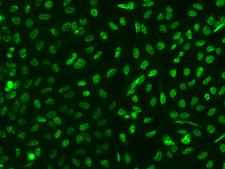TTC33 Antibody - Immunofluorescence staining of TTC33 in U2OS cells. Cells were fixed with 4% PFA, permeabilzed with 0.1% Triton X-100 in PBS, blocked with 10% serum, and incubated with rabbit anti-Human TTC33 polyclonal antibody (dilution ratio 1:200) at 4°C overnight. Then cells were stained with the Alexa Fluor 488-conjugated Goat Anti-rabbit IgG secondary antibody (green). Positive staining was localized to Nucleus.