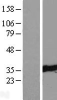 TTC33 Protein - Western validation with an anti-DDK antibody * L: Control HEK293 lysate R: Over-expression lysate
