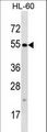 TTC34 Antibody - TTC34 Antibody western blot of HL-60 cell line lysates (35 ug/lane). The TTC34 antibody detected the TTC34 protein (arrow).