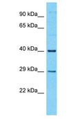 TTC34 Antibody - TTC34 antibody Western Blot of MCF7. Antibody dilution: 1 ug/ml.  This image was taken for the unconjugated form of this product. Other forms have not been tested.