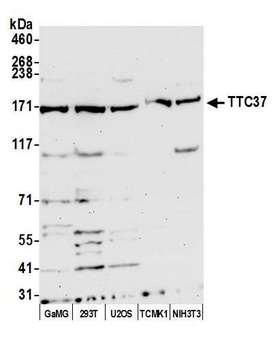 TTC37 Antibody - Detection of human and mouse TTC37 by western blot. Samples: Whole cell lysate (50 µg) from GaMG, HEK293T, U2OS, TCMK-1, and NIH 3T3 cells prepared using NETN lysis buffer. Antibody: Affinity purified Rabbit anti-TTC37 antibody used for WB at 1:1000. Secondary: HRP-conjugated goat anti-rabbit IgG (A120-101P). Chemiluminescence with an exposure time of 30 seconds.