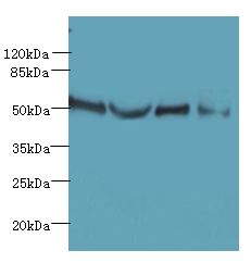 TTC38 Antibody - Western blot. All lanes: TTC38 antibody at 1.5 ug/ml. Lane 1: U251 whole cell lysate. Lane 2: Mouse liver tissue. Lane 3: HepG-2 whole cell lysate. Lane 4: K562 whole cell lysate. Secondary Goat polyclonal to Rabbit IgG at 1:10000 dilution. Predicted band size: 53 kDa. Observed band size: 53 kDa.