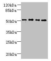 TTC38 Antibody - Western blot All lanes: TTC38 antibody at 1.5µg/ml Lane 1: U251 whole cell lysate Lane 2: Mouse liver tissue Lane 3: HepG2 whole cell lysate Lane 4: K562 whole cell lysate Secondary Goat polyclonal to rabbit IgG at 1/10000 dilution Predicted band size: 53 kDa Observed band size: 53 kDa