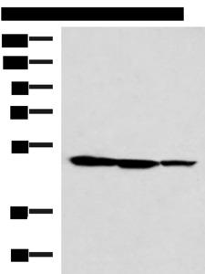 TTC38 Antibody - Western blot analysis of HepG2 K562 and A172 cell lysates  using TTC38 Polyclonal Antibody at dilution of 1:1000