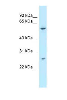 TTC39B Antibody - TTC39B antibody Western blot of Fetal Liver lysate. Antibody concentration 1 ug/ml.  This image was taken for the unconjugated form of this product. Other forms have not been tested.