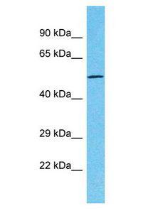 TTC39C Antibody - TTC39C antibody Western Blot of Fetal Lung. Antibody dilution: 1 ug/ml.  This image was taken for the unconjugated form of this product. Other forms have not been tested.