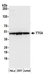 TTC4 Antibody - Detection of human TTC4 by western blot. Samples: Whole cell lysate (50 µg) from HeLa, HEK293T, and Jurkat cells prepared using NETN lysis buffer. Antibody: Affinity purified rabbit anti-TTC4 antibody used for WB at 1:1000. Detection: Chemiluminescence with an exposure time of 30 seconds.