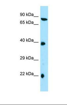 TTC4 Antibody - Western blot of Human HepG2. TTC4 antibody dilution 1.0 ug/ml.  This image was taken for the unconjugated form of this product. Other forms have not been tested.