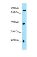 TTC4 Antibody - Western blot of Human HepG2. TTC4 antibody dilution 1.0 ug/ml.  This image was taken for the unconjugated form of this product. Other forms have not been tested.