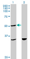 TTC4 Antibody - Western Blot analysis of TTC4 expression in transfected 293T cell line by TTC4 monoclonal antibody (M09), clone 1E10.Lane 1: TTC4 transfected lysate(44.7 KDa).Lane 2: Non-transfected lysate.