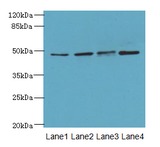 TTC5 Antibody - Western blot. All lanes: TTC5 antibody at 6 ug/ml. Lane 1: HepG-2 whole cell lysate. Lane 2: A549 whole cell lysate. Lane 3: MCF7 whole cell lysate. Lane 4: Mouse kidney tissue. Secondary Goat polyclonal to Rabbit IgG at 1:10000 dilution. Predicted band size: 49 kDa. Observed band size: 49 kDa.