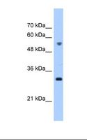 TTC5 Antibody - HepG2 cell lysate. Antibody concentration: 0.25 ug/ml. Gel concentration: 12%.  This image was taken for the unconjugated form of this product. Other forms have not been tested.