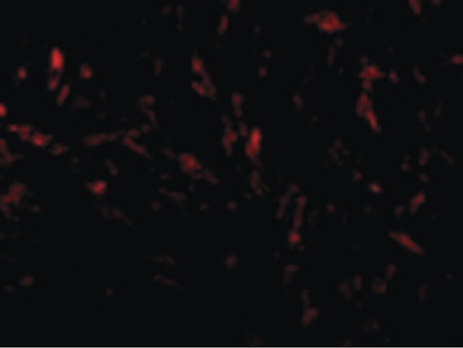 TTC5 Antibody - Immunofluorescence of TTC5 in Mouse Brain cells with TTC5 antibody at 20 ug/ml.