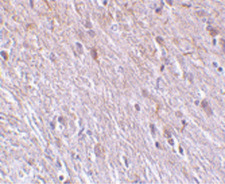 TTC5 Antibody - Immunohistochemistry of TTC5 in mouse brain tissue with TTC5 antibody at 10 ug/ml.