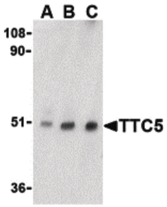 TTC5 Antibody - Western blot of TTC5 in RAW264.7 cell lysate with TTC5 antibody at (A) 0.5, (B) 1 and (C) 2 ug/ml.