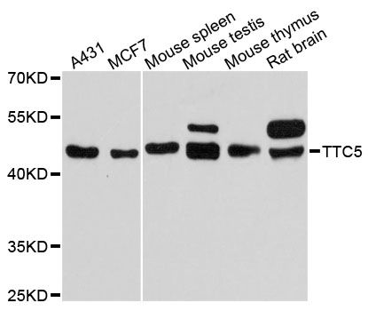 TTC5 Antibody - Western blot analysis of extracts of various cell lines, using TTC5 antibody at 1:3000 dilution. The secondary antibody used was an HRP Goat Anti-Rabbit IgG (H+L) at 1:10000 dilution. Lysates were loaded 25ug per lane and 3% nonfat dry milk in TBST was used for blocking. An ECL Kit was used for detection and the exposure time was 90s.