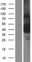 TTC5 Protein - Western validation with an anti-DDK antibody * L: Control HEK293 lysate R: Over-expression lysate