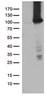 TTC7A Antibody - HEK293T cells were transfected with the pCMV6-ENTRY control. (Left lane) or pCMV6-ENTRY TTC7A. (Right lane) cDNA for 48 hrs and lysed. Equivalent amounts of cell lysates. (5 ug per lane) were separated by SDS-PAGE and immunoblotted with anti-TTC7A. (1:2000)