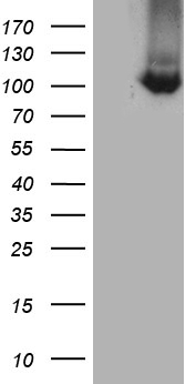 TTC7A Antibody - HEK293T cells were transfected with the pCMV6-ENTRY control. (Left lane) or pCMV6-ENTRY TTC7A. (Right lane) cDNA for 48 hrs and lysed