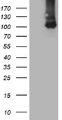 TTC7A Antibody - HEK293T cells were transfected with the pCMV6-ENTRY control. (Left lane) or pCMV6-ENTRY TTC7A. (Right lane) cDNA for 48 hrs and lysed