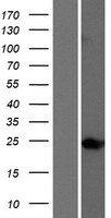 TTC9 Protein - Western validation with an anti-DDK antibody * L: Control HEK293 lysate R: Over-expression lysate