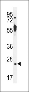 TTC9B Antibody - TTC9B Antibody western blot of mouse kidney tissue lysates (35 ug/lane). The TTC9B antibody detected the TTC9B protein (arrow).