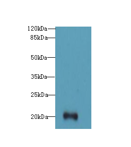 TTC9C Antibody - Western blot. All lanes: TTC9C antibody at 12 ug/ml+Tho-1 whole cell lysate Goat polyclonal to rabbit at 1:10000 dilution. Predicted band size: 20 kDa. Observed band size: 20 kDa.