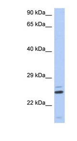TTC9C Antibody - TTC9C antibody Western blot of Fetal Thymus lysate. This image was taken for the unconjugated form of this product. Other forms have not been tested.