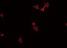 TTF / RHOH Antibody - Staining A549 cells by IF/ICC. The samples were fixed with PFA and permeabilized in 0.1% Triton X-100, then blocked in 10% serum for 45 min at 25°C. The primary antibody was diluted at 1:200 and incubated with the sample for 1 hour at 37°C. An Alexa Fluor 594 conjugated goat anti-rabbit IgG (H+L) antibody, diluted at 1/600, was used as secondary antibody.