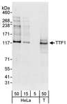 TTF1 / Txn Termination Factor Antibody - Detection of Human TTF1 by Western Blot. Samples: Whole cell lysate from HeLa (5, 15 and 50 ug) and 293T (T; 50 ug) cells. Antibodies: Affinity purified rabbit anti-TTF1 antibody used for WB at 0.04 ug/ml. Detection: Chemiluminescence with an exposure time of 30 seconds.