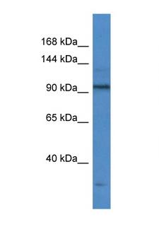 TTF1 / Txn Termination Factor Antibody - TTF1 antibody Western blot of Fetal Liver lysate. Antibody concentration 1 ug/ml.  This image was taken for the unconjugated form of this product. Other forms have not been tested.