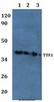 TTF1 / Txn Termination Factor Antibody - Western blot of TTF1 antibody at 1:500 Line1:HEK293T whole cell lysate Line2:H9C2 whole cell lysate Line3:Raw264.7 whole cell lysate.