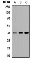 TTF1 / Txn Termination Factor Antibody - Western blot analysis of TTF1 expression in HEK293T (A); Raw264.7 (B); H9C2 (C) whole cell lysates.