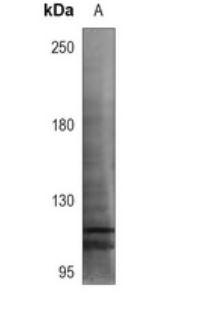 TTF1 / Txn Termination Factor Antibody - Western blot analysis of TTF1 expression in HEK293T (A) whole  cell lysates. (Predicted band size: 103 kD; Observed band size:  103 kD)