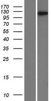 TTF1 / Txn Termination Factor Protein - Western validation with an anti-DDK antibody * L: Control HEK293 lysate R: Over-expression lysate