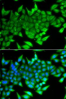 TTF2 / HuF2 Antibody - Immunofluorescence analysis of A549 cells.