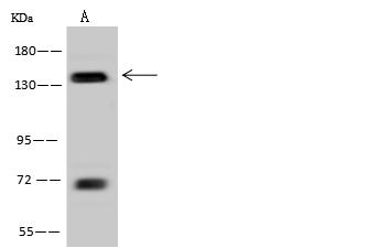 TTF2 / HuF2 Antibody - Anti-TTF2 rabbit polyclonal antibody at 1:500 dilution. Lane A: Jurkat Whole Cell Lysate. Lysates/proteins at 30 ug per lane. Secondary: Goat Anti-Rabbit IgG (H+L)/HRP at 1/10000 dilution. Developed using the ECL technique. Performed under reducing conditions. Predicted band size: 130 kDa. Observed band size: 130 kDa.