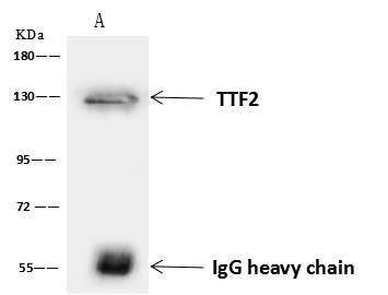 TTF2 / HuF2 Antibody - TTF2 was immunoprecipitated using: Lane A: 0.5 mg Jurkat Whole Cell Lysate. 4 uL anti-TTF2 rabbit polyclonal antibody and 60 ug of Immunomagnetic beads Protein A/G. Primary antibody: Anti-TTF2 rabbit polyclonal antibody, at 1:100 dilution. Secondary antibody: Goat Anti-Rabbit IgG (H+L)/HRP at 1/10000 dilution. Developed using the ECL technique. Performed under reducing conditions. Predicted band size: 130 kDa. Observed band size: 150 kDa.