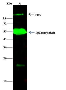 TTF2 / HuF2 Antibody - TTF2 was immunoprecipitated using: Lane A: 0.5 mg Hela Whole Cell Lysate. 1 uL anti-TTF2 rabbit polyclonal antibody and 15 ul of 50% Protein G agarose. Primary antibody: Anti-TTF2 rabbit polyclonal antibody, at 1:500 dilution. Secondary antibody: Dylight 800-labeled antibody to rabbit IgG (H+L), at 1:5000 dilution. Developed using the odssey technique. Performed under reducing conditions. Predicted band size: 127 kDa. Observed band size: 127 kDa.