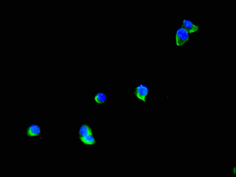 TTI1 Antibody - Immunofluorescent analysis of Hela cells using TTI1 Antibody at a dilution of 1:100 and Alexa Fluor 488-congugated AffiniPure Goat Anti-Rabbit IgG(H+L)