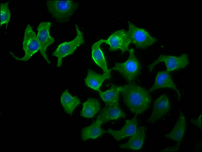 TTI2 / C8orf41 Antibody - Immunofluorescence staining of A549 cells diluted at 1:33, counter-stained with DAPI. The cells were fixed in 4% formaldehyde, permeabilized using 0.2% Triton X-100 and blocked in 10% normal Goat Serum. The cells were then incubated with the antibody overnight at 4°C.The Secondary antibody was Alexa Fluor 488-congugated AffiniPure Goat Anti-Rabbit IgG (H+L).