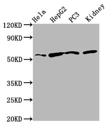TTI2 / C8orf41 Antibody - Western Blot Positive WB detected in: Hela whole cell lysate, HepG2 whole cell lysate, PC3 whole cell lysate, Rat kidney tissue All Lanes: TTI2 antibody at 8.7µg/ml Secondary Goat polyclonal to rabbit IgG at 1/50000 dilution Predicted band size: 57 KDa Observed band size: 57 KDa