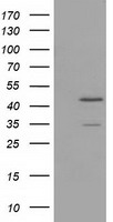 TTL Antibody - HEK293T cells were transfected with the pCMV6-ENTRY control (Left lane) or pCMV6-ENTRY TTL (Right lane) cDNA for 48 hrs and lysed. Equivalent amounts of cell lysates (5 ug per lane) were separated by SDS-PAGE and immunoblotted with anti-TTL.
