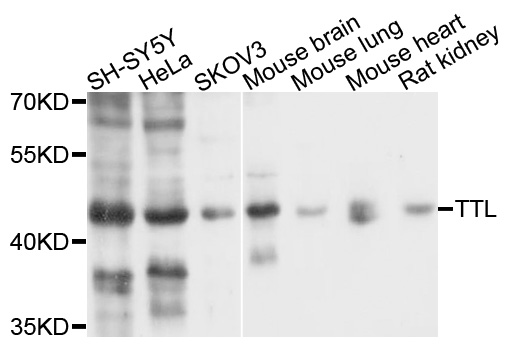 TTL Antibody - Western blot analysis of extracts of various cell lines, using TTL antibody at 1:1000 dilution. The secondary antibody used was an HRP Goat Anti-Rabbit IgG (H+L) at 1:10000 dilution. Lysates were loaded 25ug per lane and 3% nonfat dry milk in TBST was used for blocking. An ECL Kit was used for detection and the exposure time was 1s.